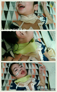 お風呂アイテム 気切孔への浸水予防 ウエスト症候群 ケアチャネル